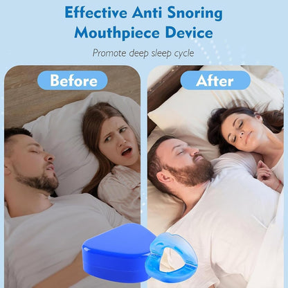 Anti Snore Mouth-Piece — Sleep Better, Snore Less